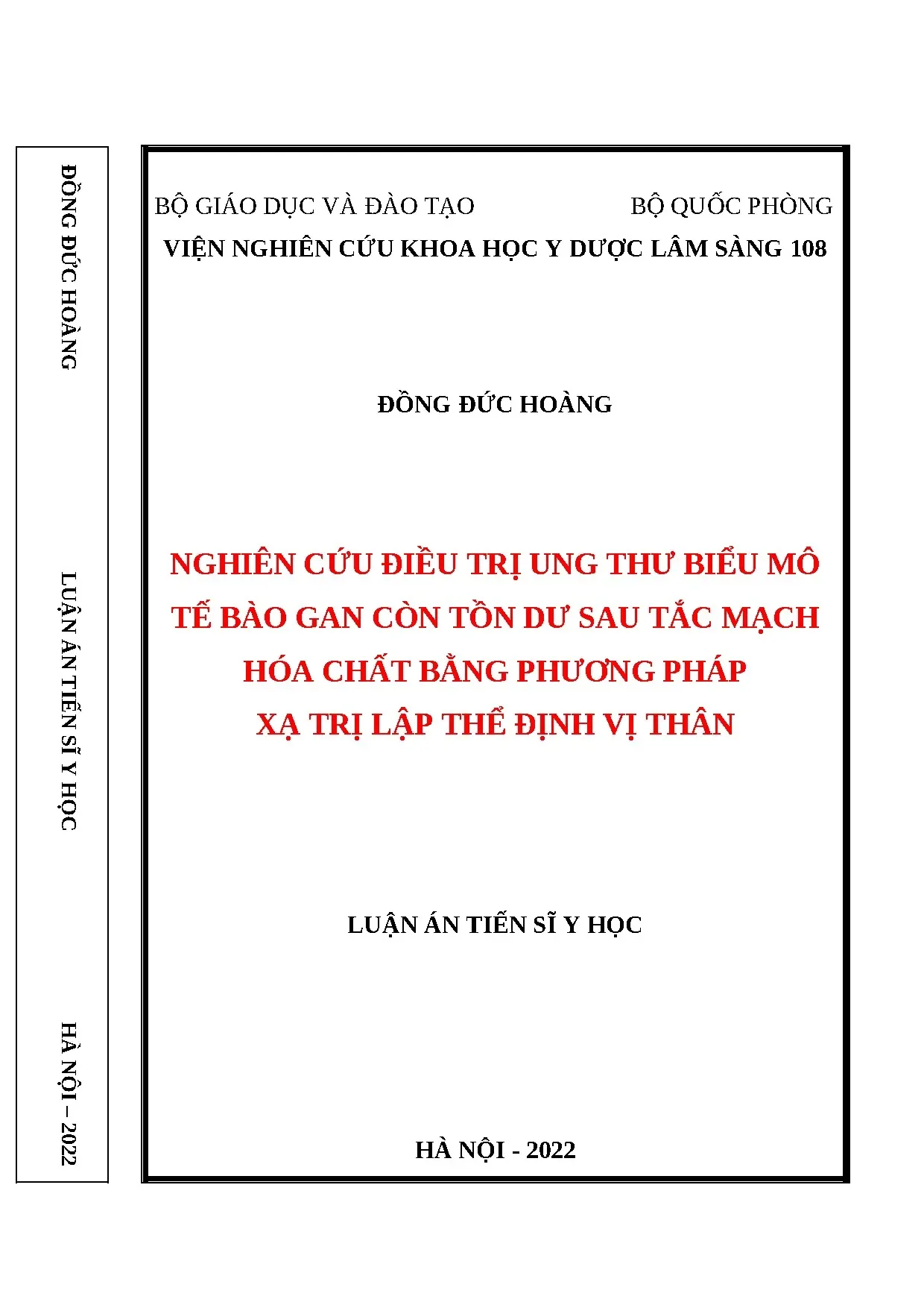 Xạ trị SBRT cho ung thư gan tồn dư sau tắc mạch hóa chất